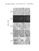 TUMOR-SPECIFIC PROMOTER AND ONCOLYTIC VIRUS VECTOR COMPRISING THE SAME diagram and image