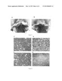 FUSION POLYPEPTIDE AGAINST EB VIRUS-INDUCED TUMOR AND COLICIN IA MUTANT diagram and image