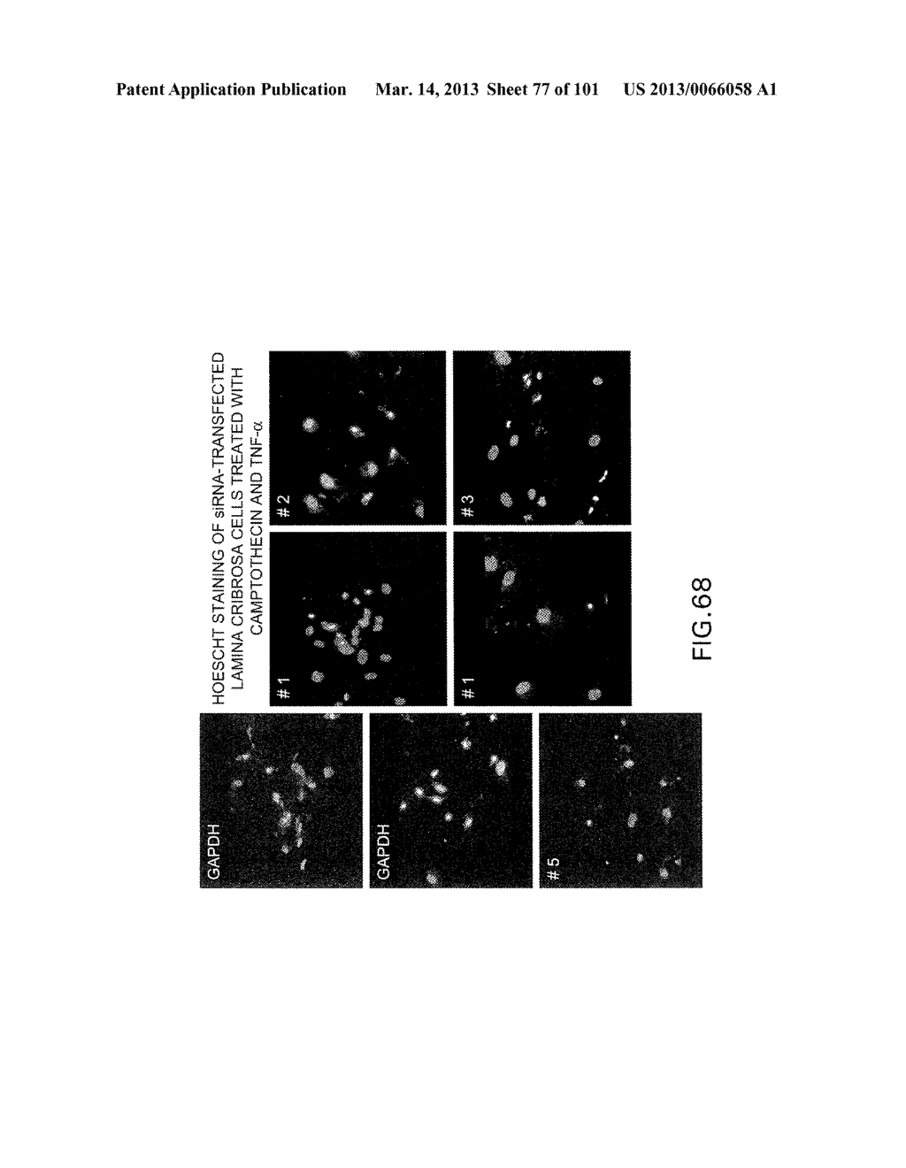 Use of Antisense Oligonucleotides or siRNA to Suppress Expression of     eIF-5A1 - diagram, schematic, and image 78