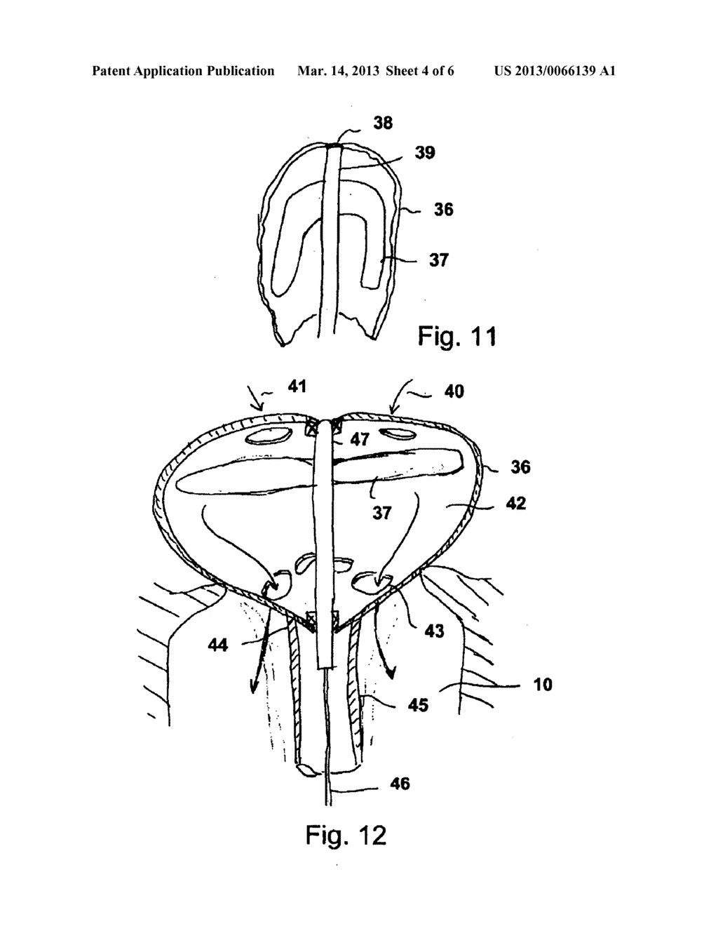 PUMP OR ROTARY CUTTER FOR OPERATION IN A FLUID - diagram, schematic, and image 05