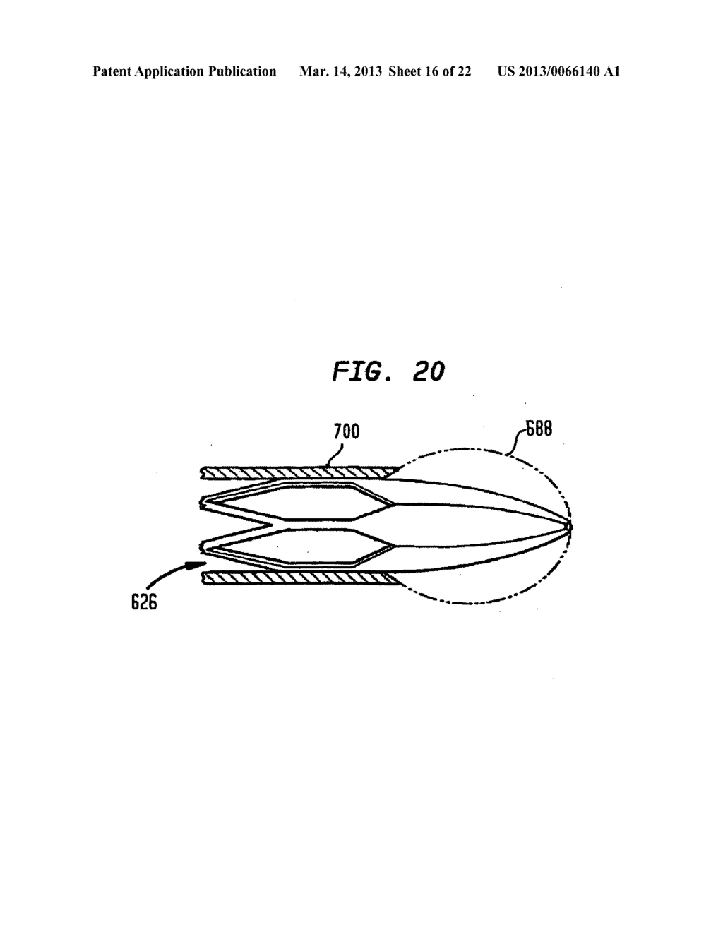 HEART ASSIST DEVICE WITH EXPANDABLE IMPELLER PUMP - diagram, schematic, and image 17