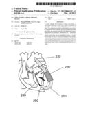 IMPLANTABLE CARDIAC THERAPY DEVICE diagram and image