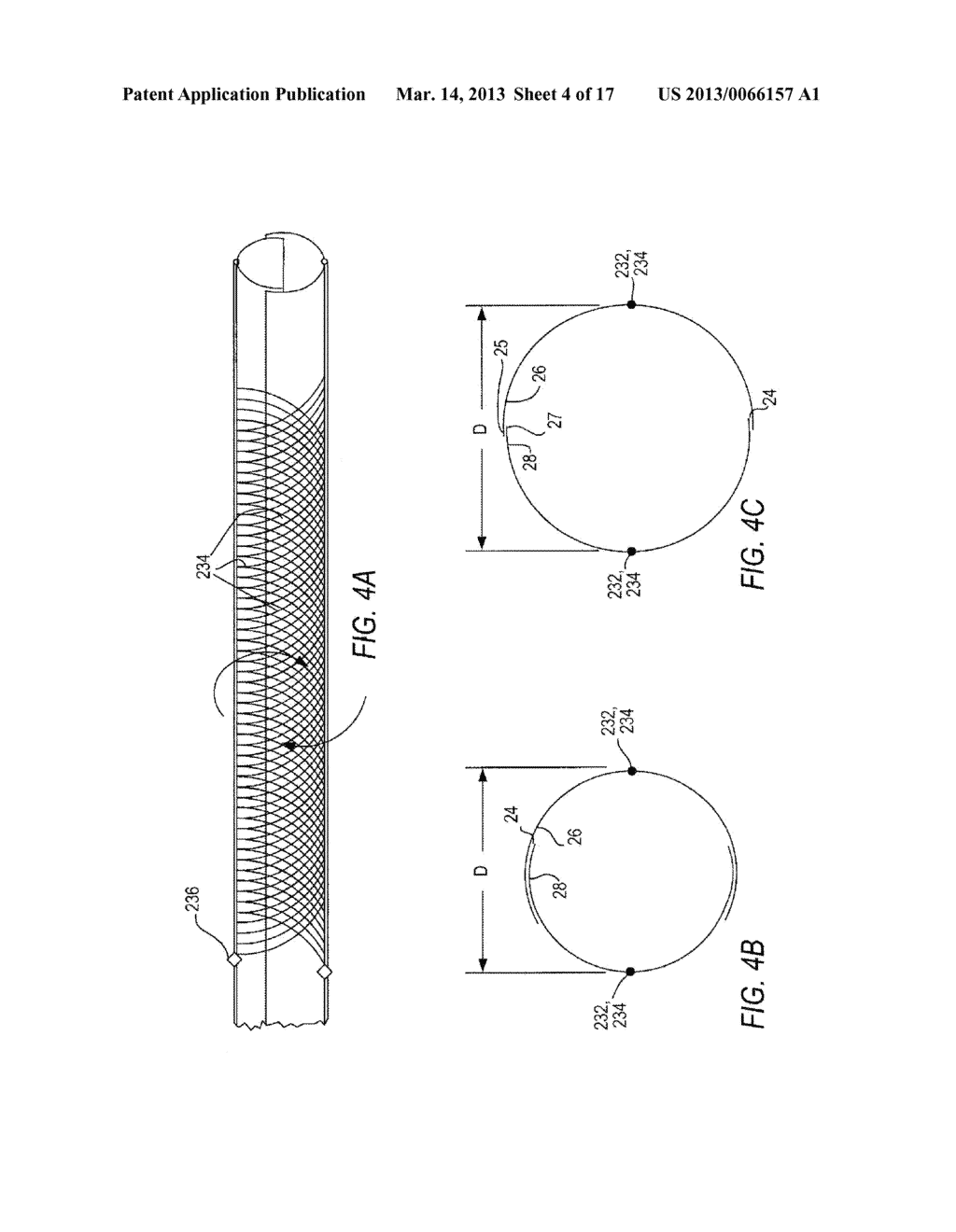 SYSTEM FOR BODY ACCESS HAVING ADJUSTABLE DIMENSIONS - diagram, schematic, and image 05