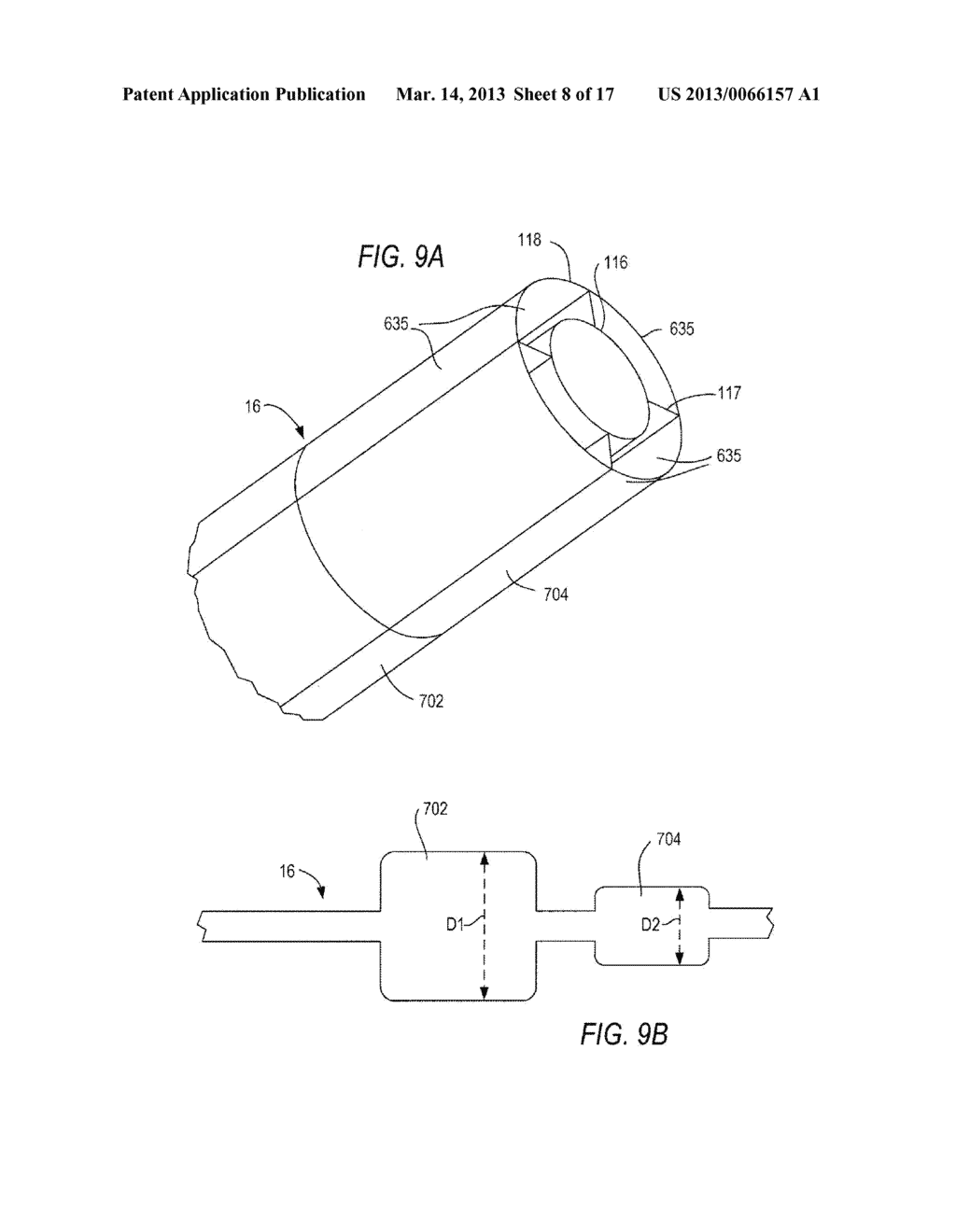 SYSTEM FOR BODY ACCESS HAVING ADJUSTABLE DIMENSIONS - diagram, schematic, and image 09