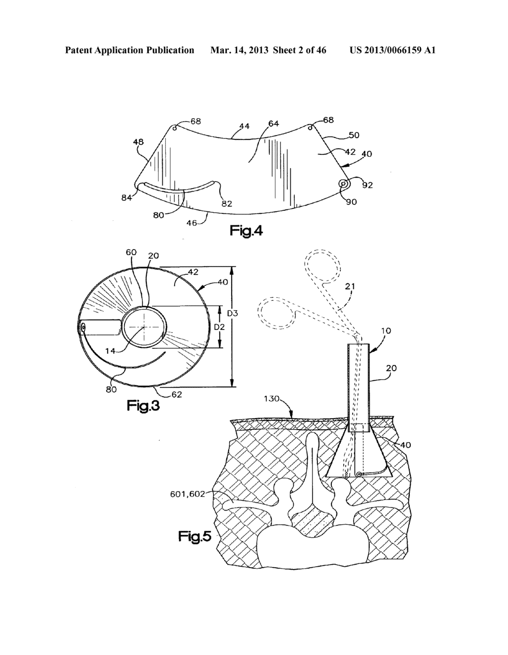 METHOD FOR SECURING VERTEBRAE - diagram, schematic, and image 03