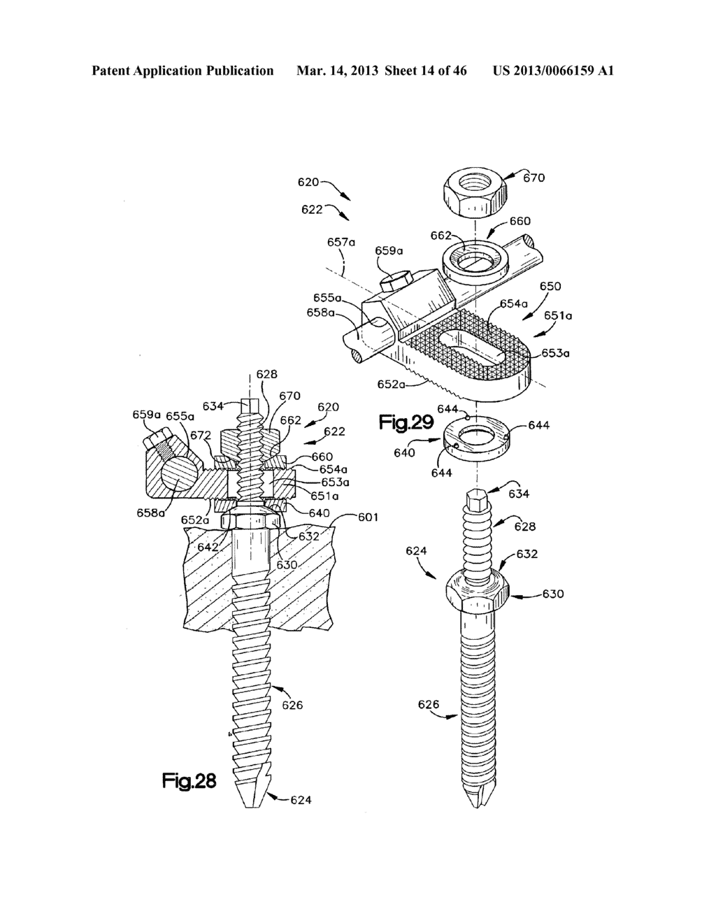 METHOD FOR SECURING VERTEBRAE - diagram, schematic, and image 15