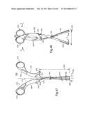 METHOD FOR SECURING VERTEBRAE diagram and image