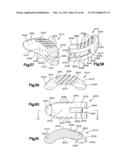 METHOD FOR SECURING VERTEBRAE diagram and image