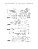 METHOD FOR SECURING VERTEBRAE diagram and image