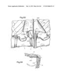 METHOD FOR SECURING VERTEBRAE diagram and image