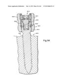 METHOD FOR SECURING VERTEBRAE diagram and image