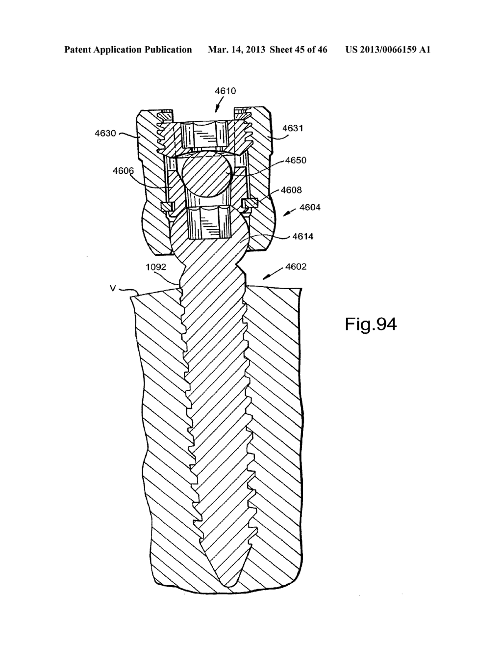 METHOD FOR SECURING VERTEBRAE - diagram, schematic, and image 46