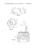 CANNULA FOR RECEIVING SURGICAL INSTRUMENTS diagram and image