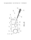 CANNULA FOR RECEIVING SURGICAL INSTRUMENTS diagram and image