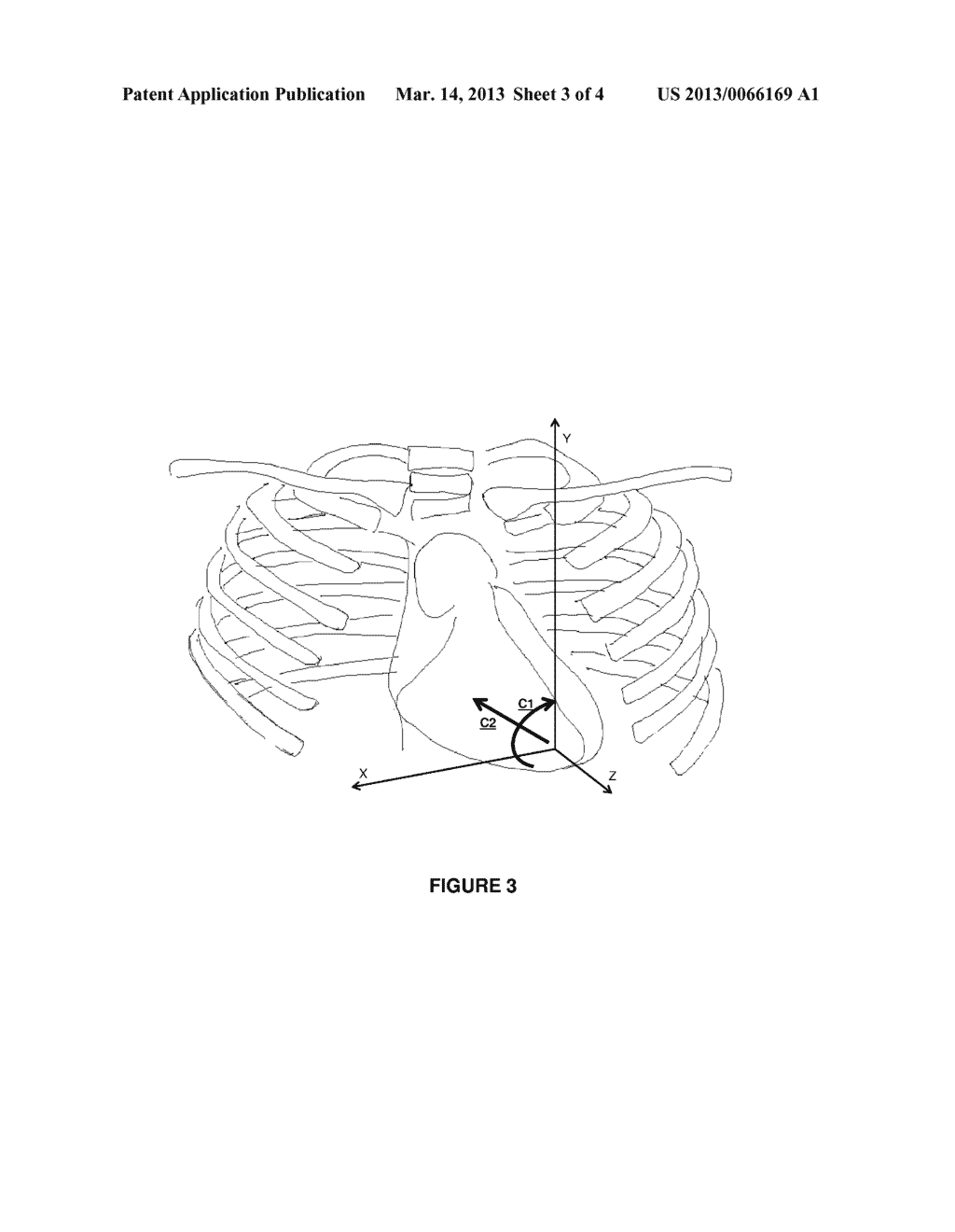 CONTROLLING WIRELESS COMMUNICATION IN AN IMPLANTED CARDIAC DEVICE - diagram, schematic, and image 04