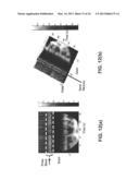 VENOUS OXYGEN SATURATION SYSTEMS AND METHODS diagram and image