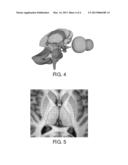 NORMATIVE DATASET FOR NEUROPSYCHIATRIC DISORDERS diagram and image