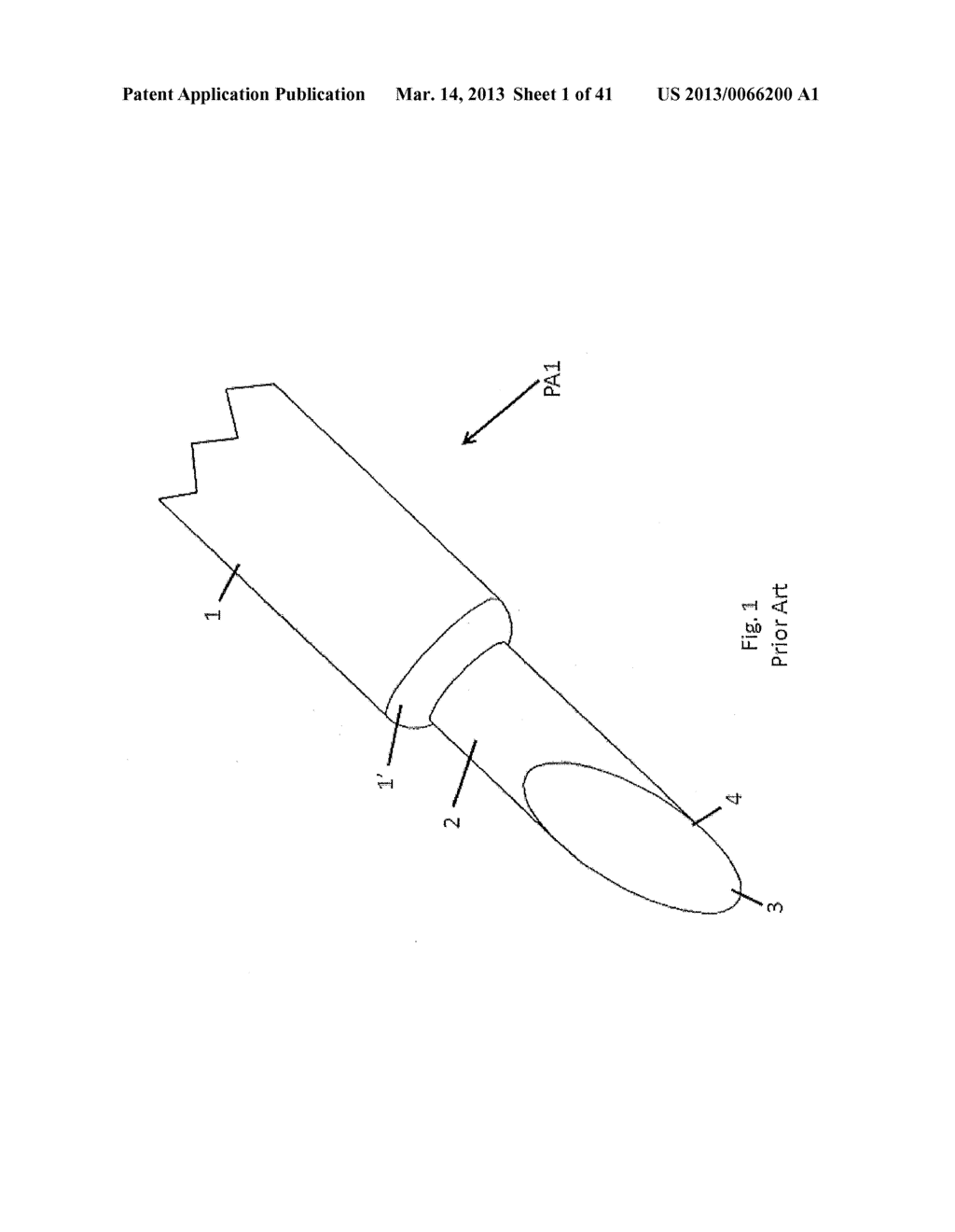 MEDICAL TOOL FOR REDUCED PENETRATION FORCE WITH FEEDBACK MEANS - diagram, schematic, and image 02