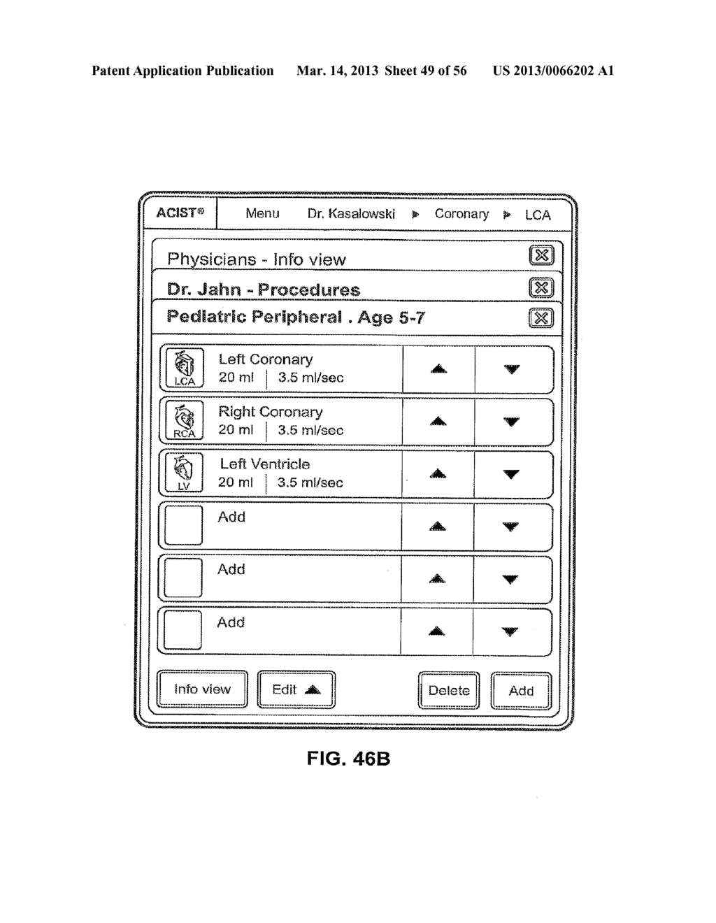 MEDICAL FLUID INJECTION SYSTEM - diagram, schematic, and image 50