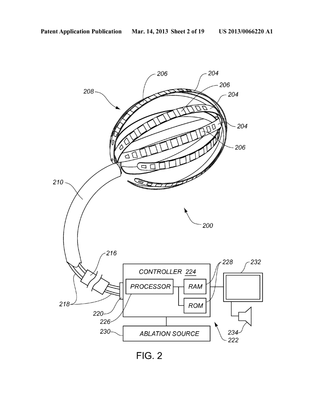 INTRA-CARDIAC MAPPING AND ABLATING - diagram, schematic, and image 03