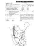 SYSTEMS AND METHODS FOR DETECTING FAR-FIELD OVERSENSING BASED ON SIGNALS     SENSED BY THE PROXIMAL ELECTRODE OF A MULTIPOLAR LV LEAD diagram and image