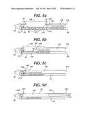 Biopsy Device with Sample Storage diagram and image