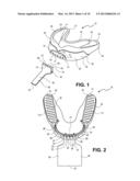 MOUTHGUARD APPARATUS AND RELATED METHOD diagram and image