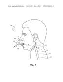 MOUTHGUARD APPARATUS AND RELATED METHOD diagram and image