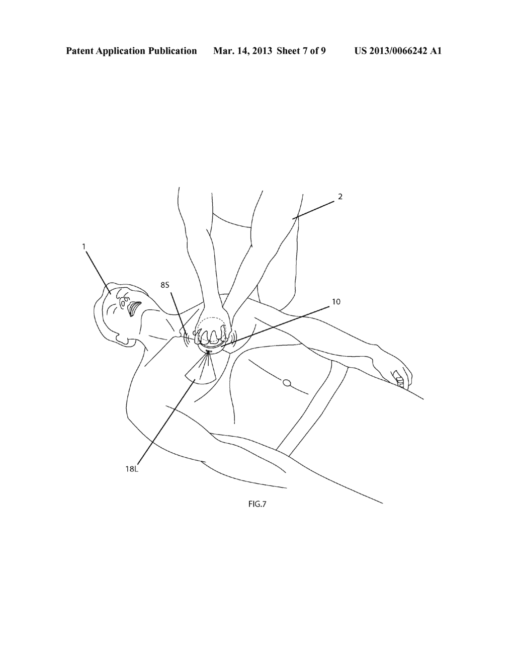 MANUAL CPR OR CCC CONTINUOUS CHEST COMPRESSION ASSIST DEVICE - diagram, schematic, and image 08