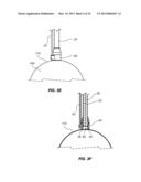 NORMALIZATION AND STABILIZATION OF BALLOON SURFACES FOR DEFLATION diagram and image