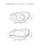 INTRODUCTORY ASSEMBLY AND METHOD FOR INSERTING INTRACARDIAC INSTRUMENTS diagram and image