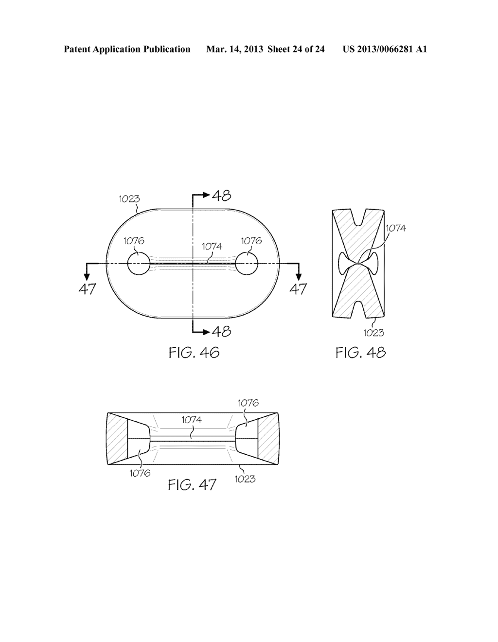 SEALING ASSEMBLY WITH PINCH VALVE STRUCTURE FOR A FLUID INFUSION DEVICE     HAVING A NEEDLED FLUID RESERVOIR - diagram, schematic, and image 25