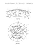 Corneal Denervation for Treatment of Ocular Pain diagram and image