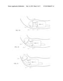 SYSTEMS AND METHODS FOR CLEANING BODY CAVITIES AND FOR ENDOSCOPIC STEERING diagram and image