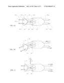 SYSTEMS AND METHODS FOR CLEANING BODY CAVITIES AND FOR ENDOSCOPIC STEERING diagram and image