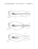 SYSTEMS AND METHODS FOR CLEANING BODY CAVITIES AND FOR ENDOSCOPIC STEERING diagram and image