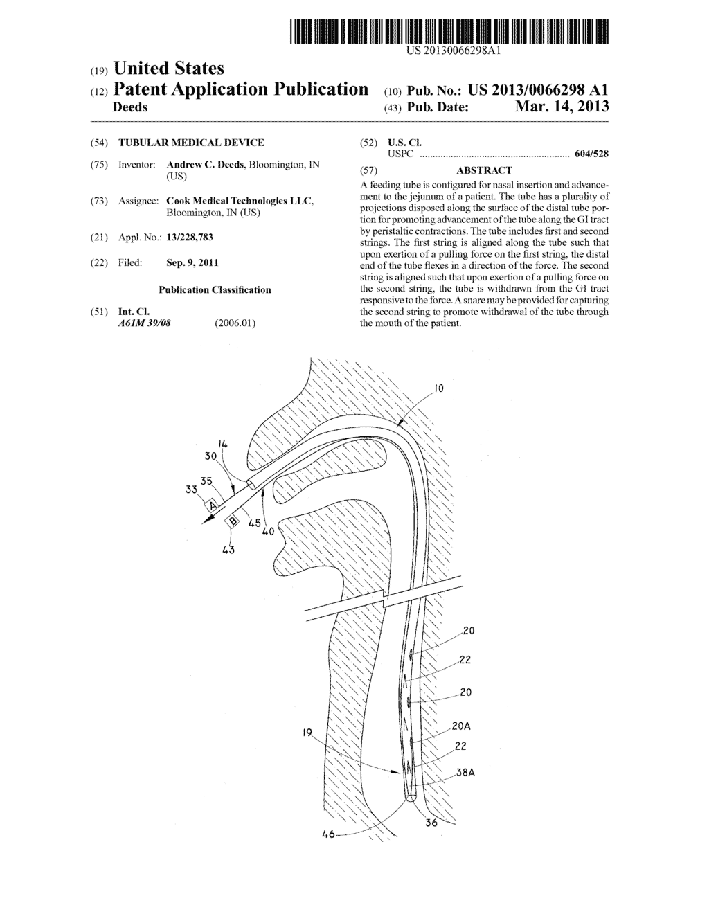 TUBULAR MEDICAL DEVICE - diagram, schematic, and image 01