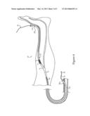 Wire Guide Grabbing Mechanism And Method diagram and image