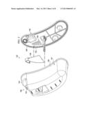 REDUCED-PRESSURE CANISTERS HAVING HYDROPHOBIC PORES diagram and image