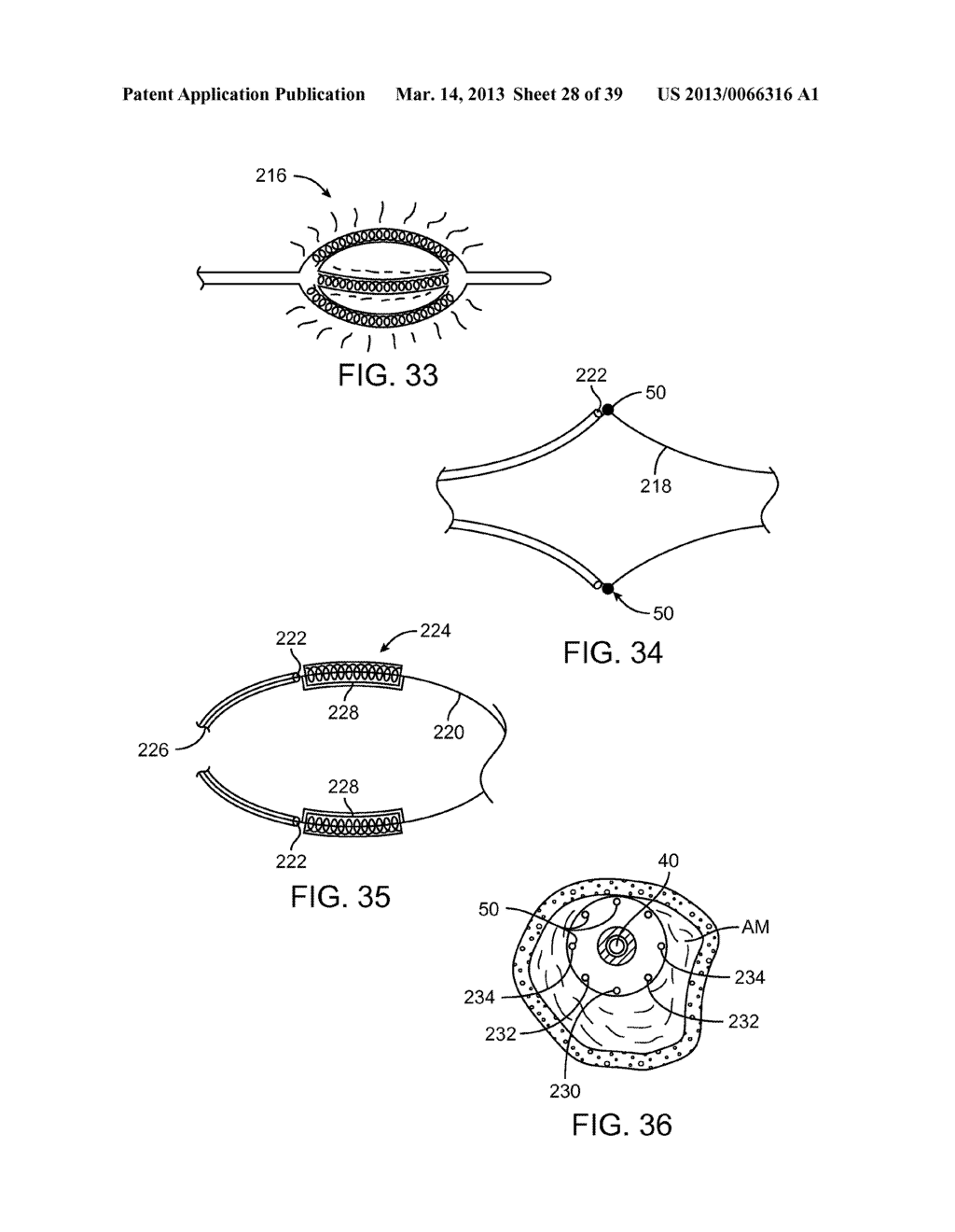 SELECTABLE ECCENTRIC REMODELING AND/OR ABLATION - diagram, schematic, and image 29