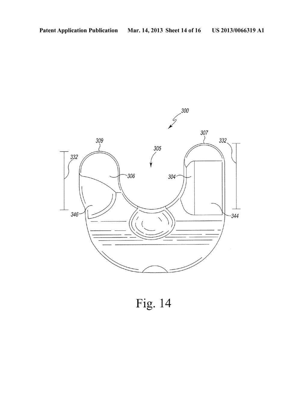 METHOD OF FABRICATING CUSTOMIZED PATIENT-SPECIFIC BONE CUTTING BLOCKS - diagram, schematic, and image 15