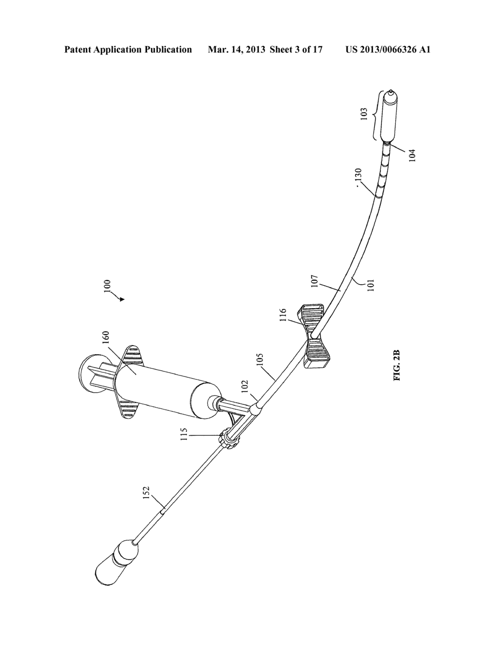 SYSTEMS AND METHODS FOR INTERNAL BONE FIXATION - diagram, schematic, and image 04