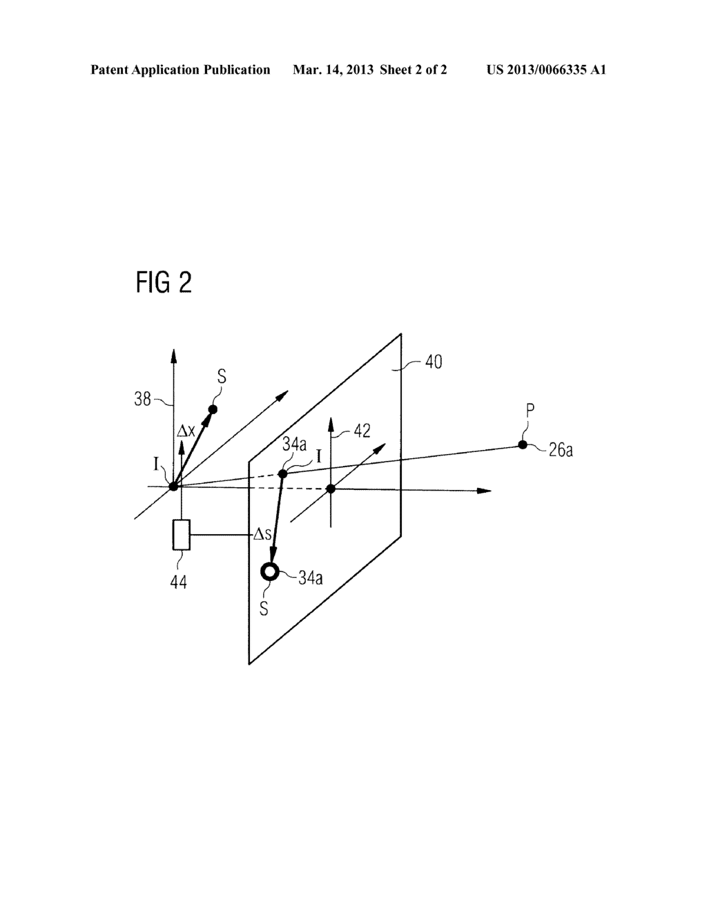 METHOD FOR MOVING AN INSTRUMENT ARM OF A LAPAROSCOPY ROBOT INTO A     PREDETERMINABLE RELATIVE POSITION WITH RESPECT TO A TROCAR - diagram, schematic, and image 03