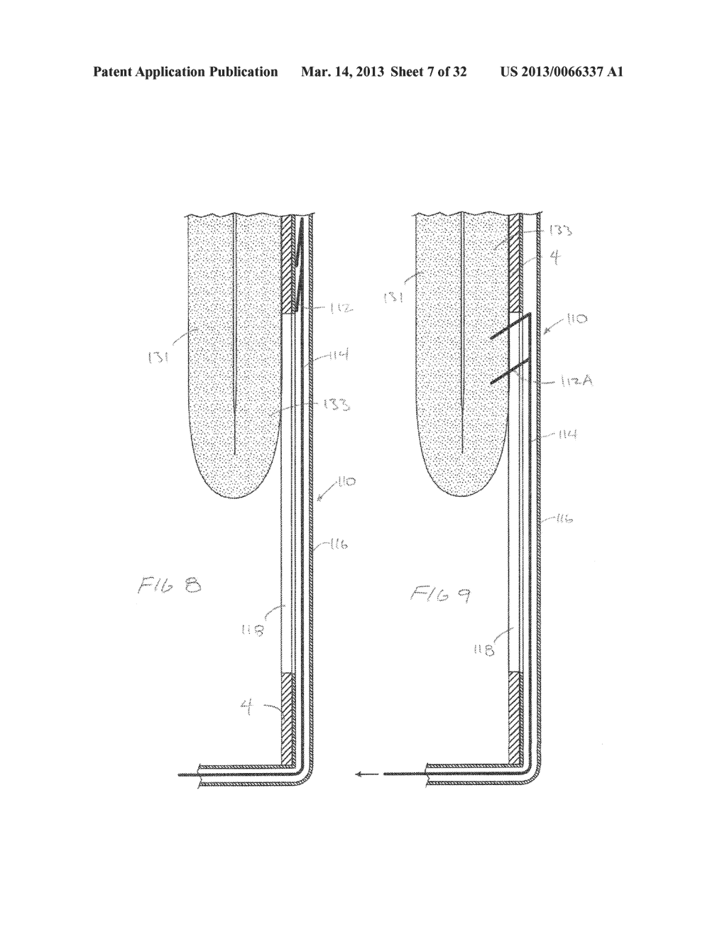 METHODS AND DEVICES FOR MANIPULATING AND FASTENING TISSUE - diagram, schematic, and image 08