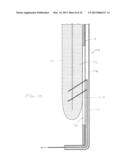 METHODS AND DEVICES FOR MANIPULATING AND FASTENING TISSUE diagram and image