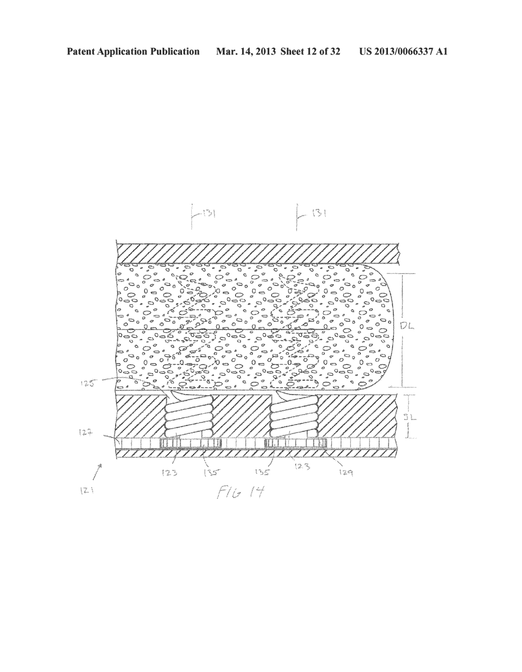 METHODS AND DEVICES FOR MANIPULATING AND FASTENING TISSUE - diagram, schematic, and image 13