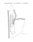 METHODS AND DEVICES FOR MANIPULATING AND FASTENING TISSUE diagram and image