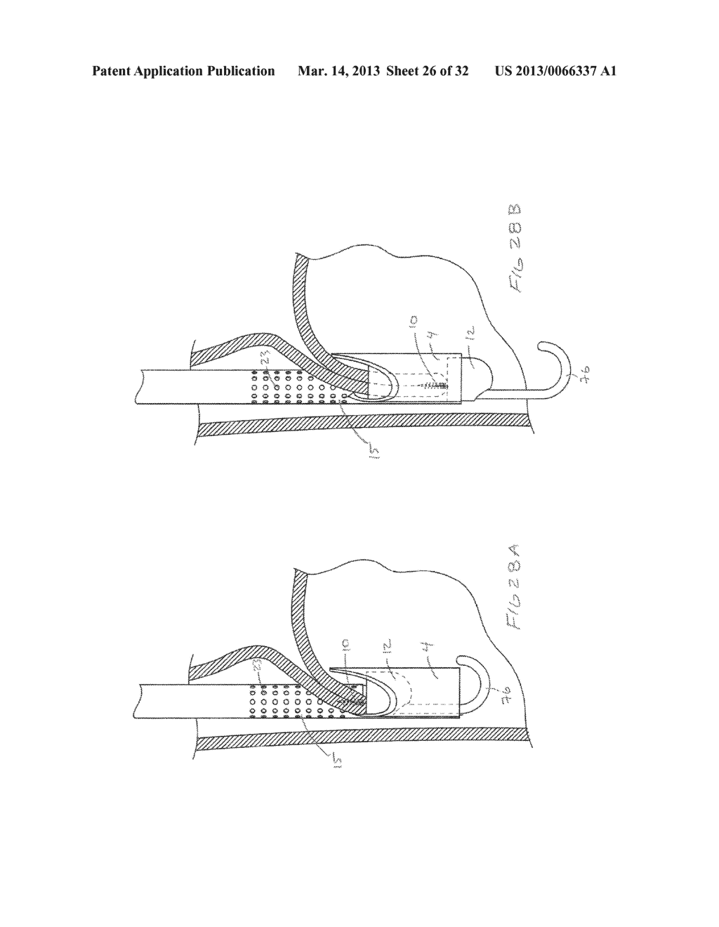 METHODS AND DEVICES FOR MANIPULATING AND FASTENING TISSUE - diagram, schematic, and image 27