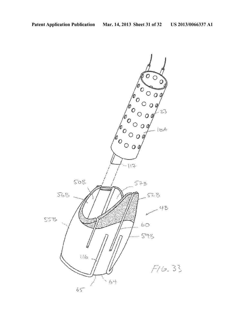 METHODS AND DEVICES FOR MANIPULATING AND FASTENING TISSUE - diagram, schematic, and image 32