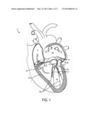 GRIPPER PUSHER MECHANISM FOR TISSUE APPOSITION SYSTEMS diagram and image